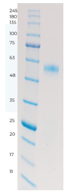 Figure 2 Purified target protein