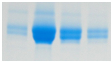 Figure 1 Double band