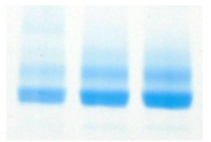 Figure 2 double band still present post Endo H